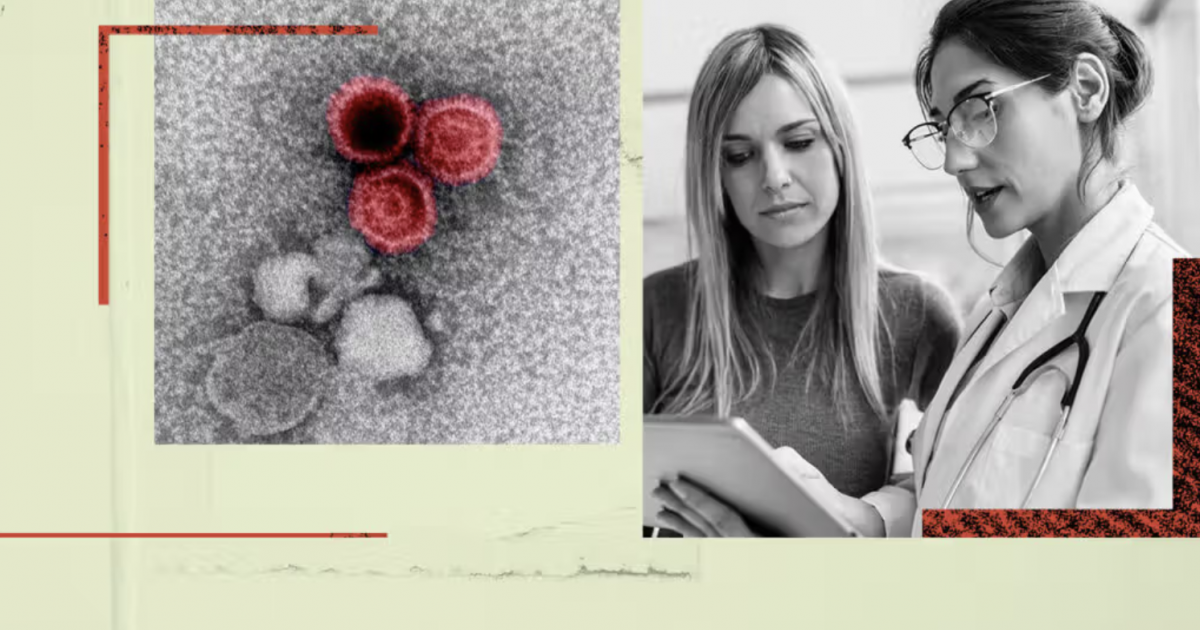 اكتشاف جديد يوضح العلاقة بين مرض التقبيل ومرض الذئبة الحمراء