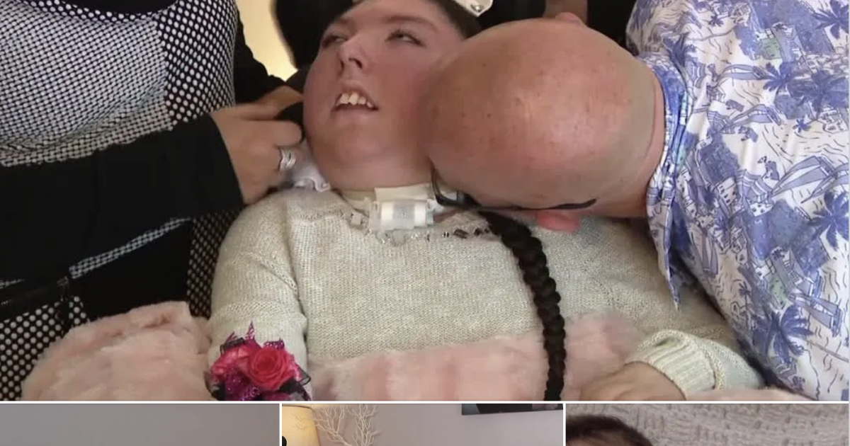 الاستسقاء الدماغي الكامل: شابة في العشرين وُلدت دون معظم دماغها