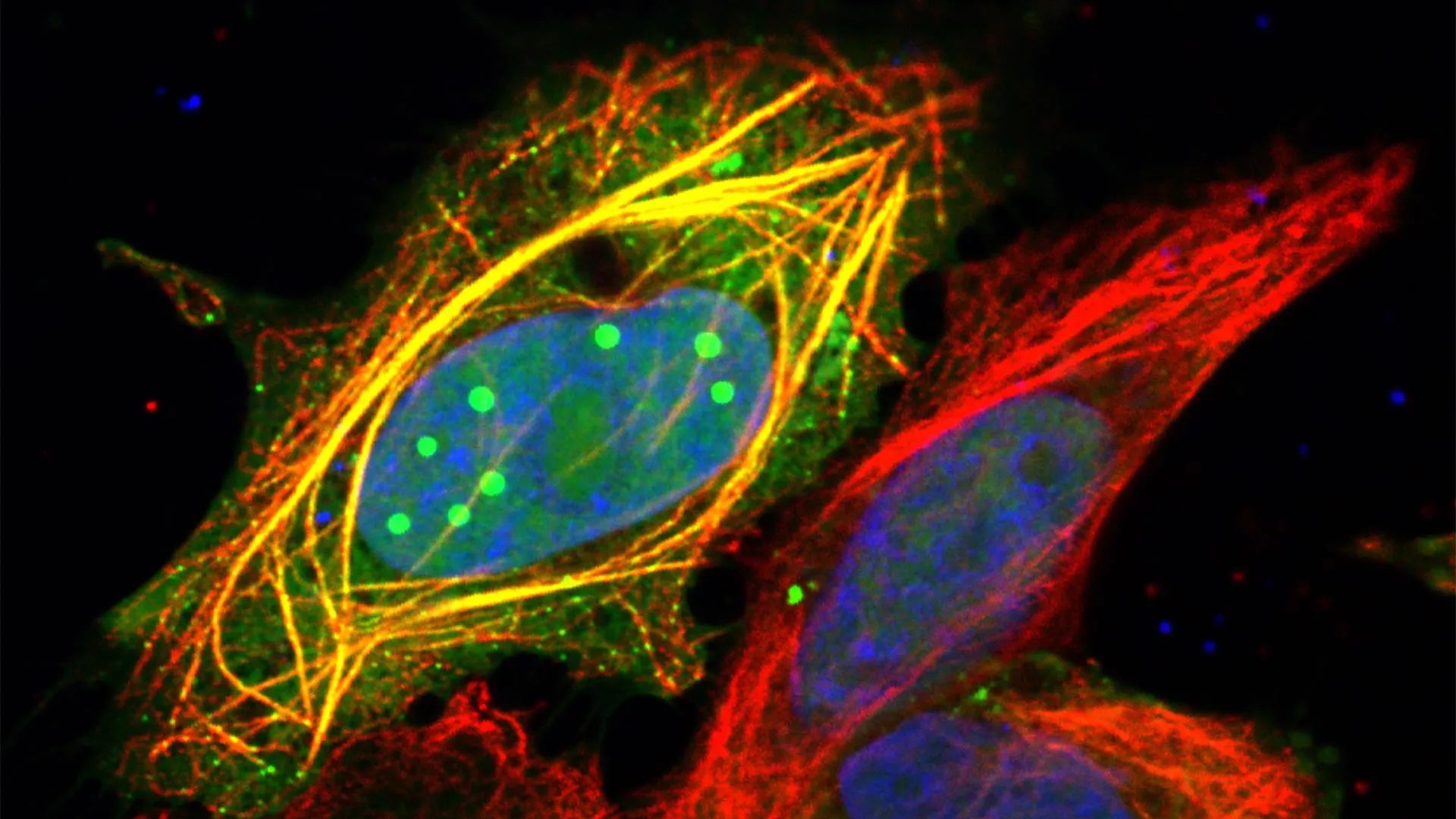 بروتين متغير الشكل يفسر القوة المميتة لداء الكلب