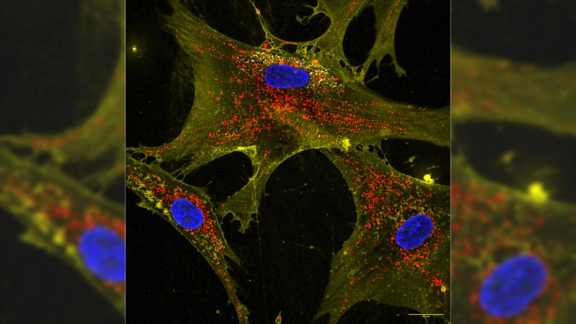 تعمل زهور النانو على شحن الخلايا الجذعية لإعادة شحن خلايا الشيخوخة