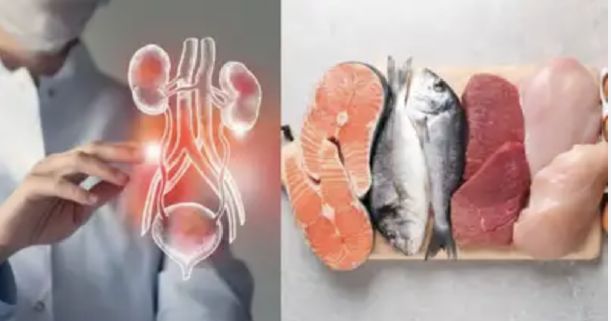 ما العلاقة بين اللحوم والتهاب المسالك البولية؟