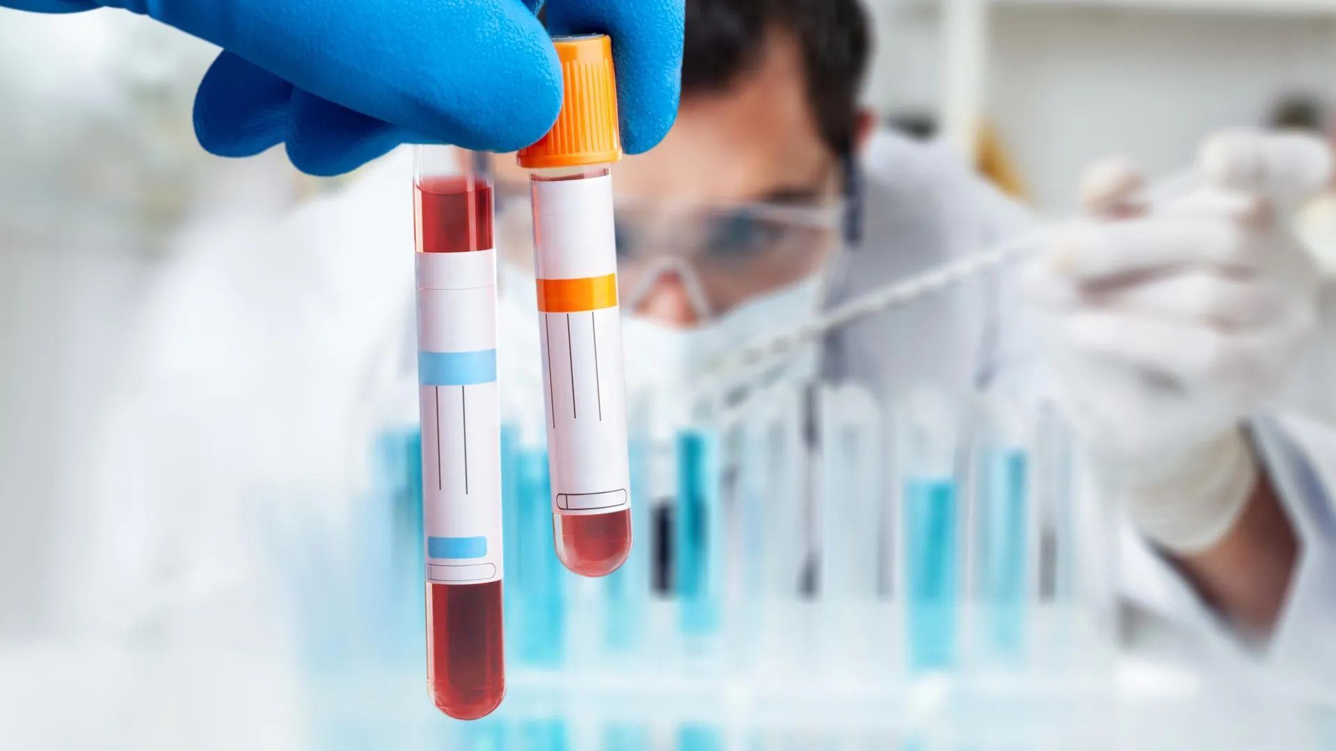 يؤكد اختبار الدم الاختراقي أخيرًا متلازمة التعب المزمن