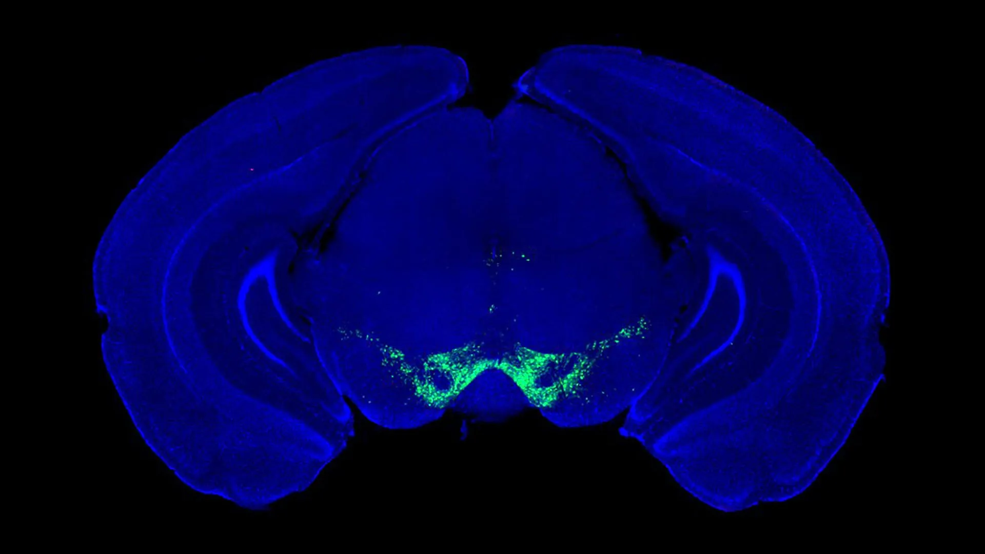 إن اكتشاف مرض باركنسون يغير ما نعرفه عن الدوبامين