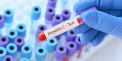 اختبار التهاب الكبد C الذي يستغرق 15 دقيقة يمكن أن يغير كل شيء