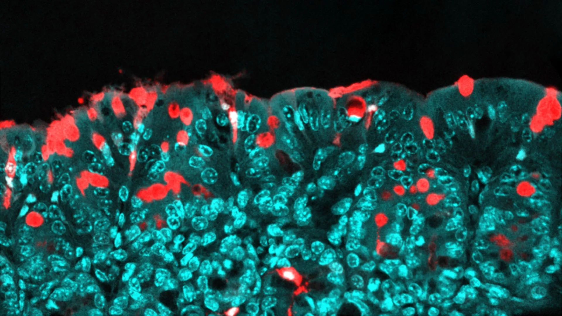 قد يشكل هذا المكون الغذائي الشائع صحة الطفل مدى الحياة