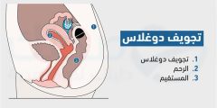 كتلة في تجويف دوغلاس .. حميدة أم خبيثة؟