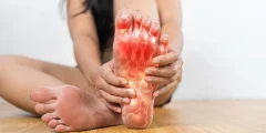 نصائح TikTok بشأن النقرس منتشرة في كل مكان، ويقول الأطباء إنها غالبًا ما تكون خاطئة