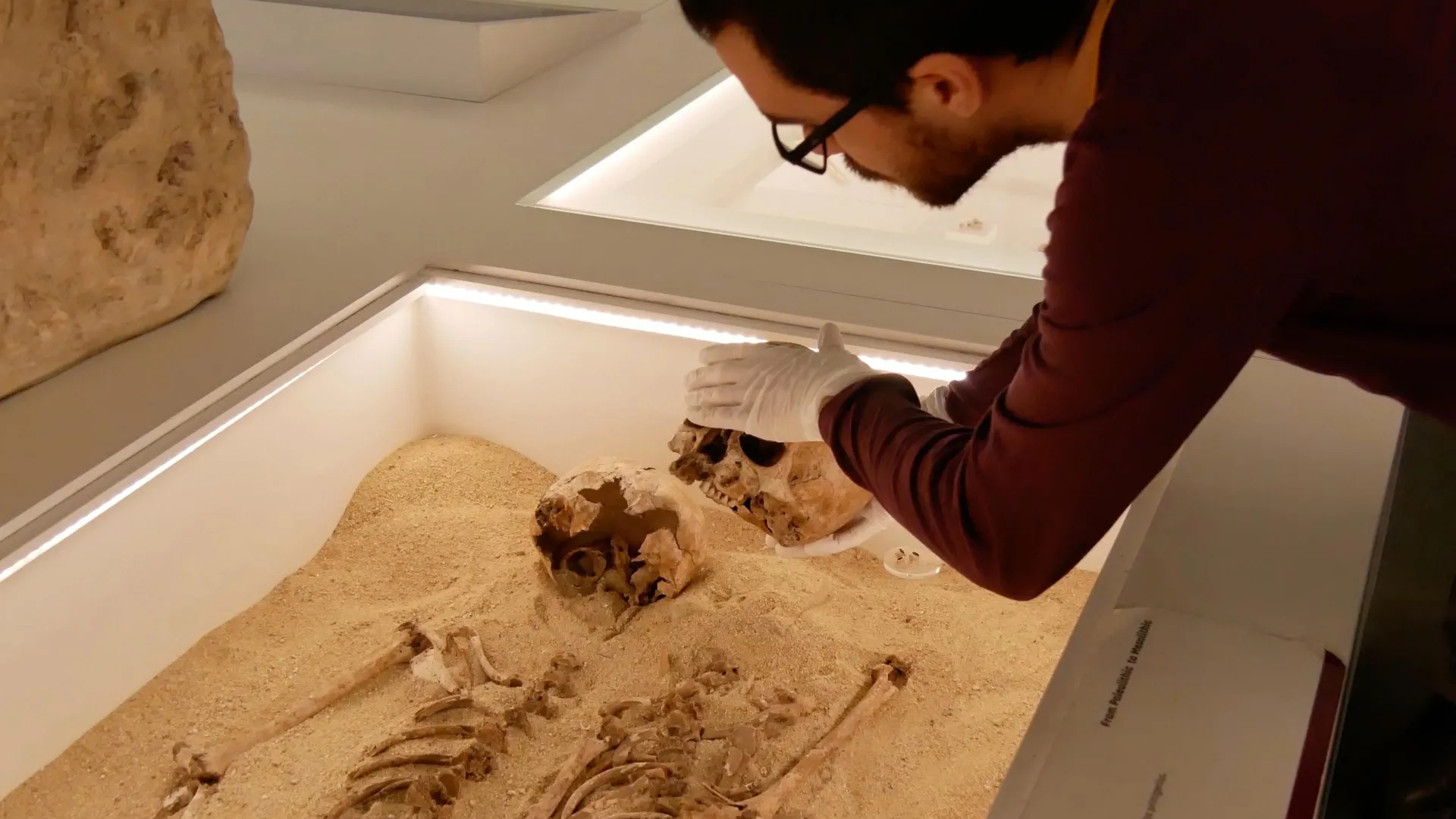 الحمض النووي القديم يحل لغزًا عمره 12000 عام لاضطراب النمو الوراثي النادر