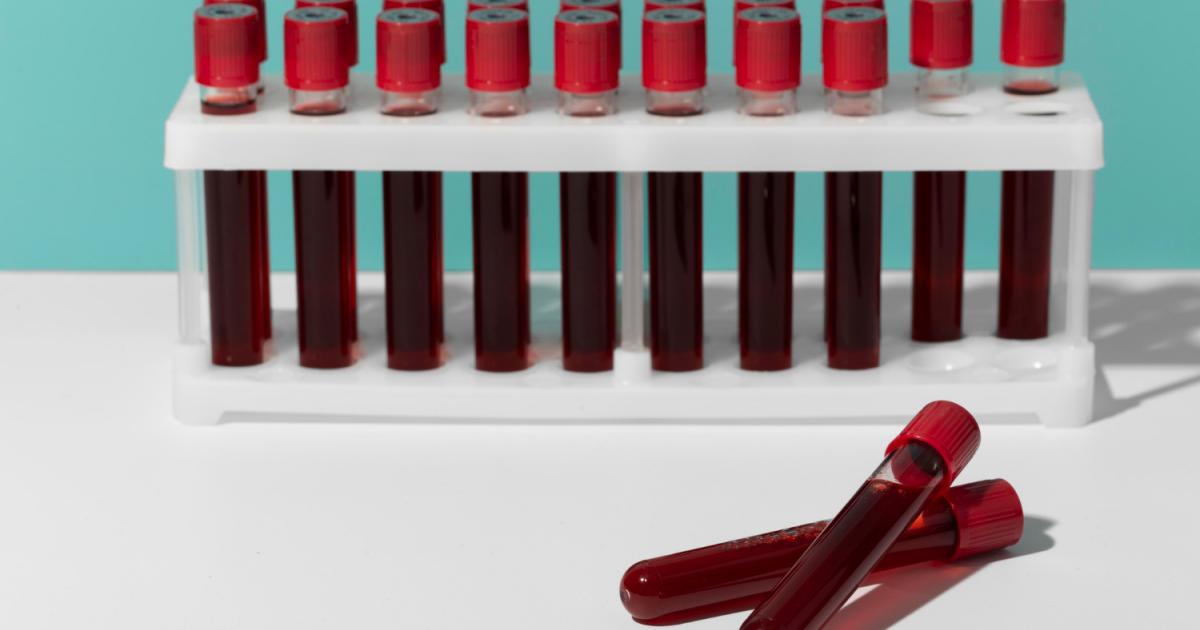 الخزعة السائلة قد توفر نتائج أسرع حول فعالية علاجات سرطان الثدي