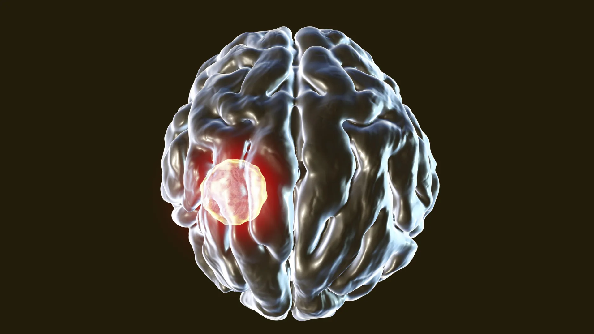 يحمل واحد من كل ثلاثة أشخاص هذا الطفيل الدماغي، لكن الجسم لديه مفتاح قتل