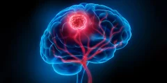 يجد العلماء خلايا دماغية مخفية تساعد على نمو السرطان القاتل