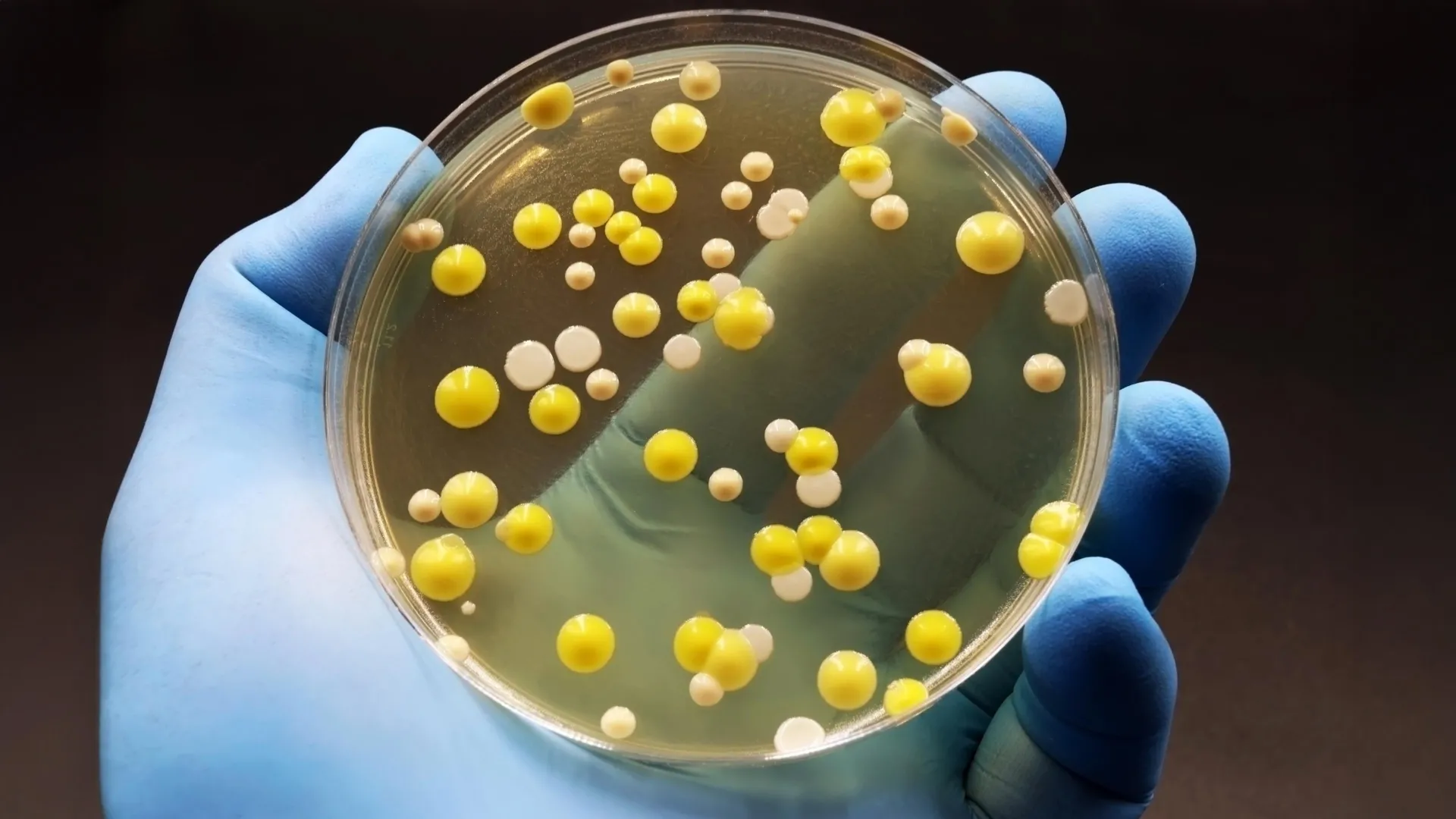 يقتل الجرافين البكتيريا الضارة “الجراثيم الخارقة” ولكنه يحافظ على الخلايا البشرية