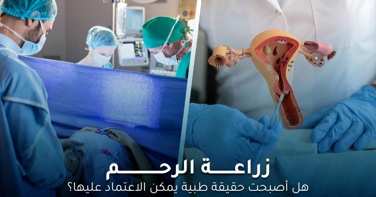 هل أصبحت زراعة الرحم حقيقة طبية يمكن الاعتماد عليها؟