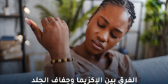 الفرق بين الإكزيما وجفاف الجلد: كيفية التمييز والعلاج