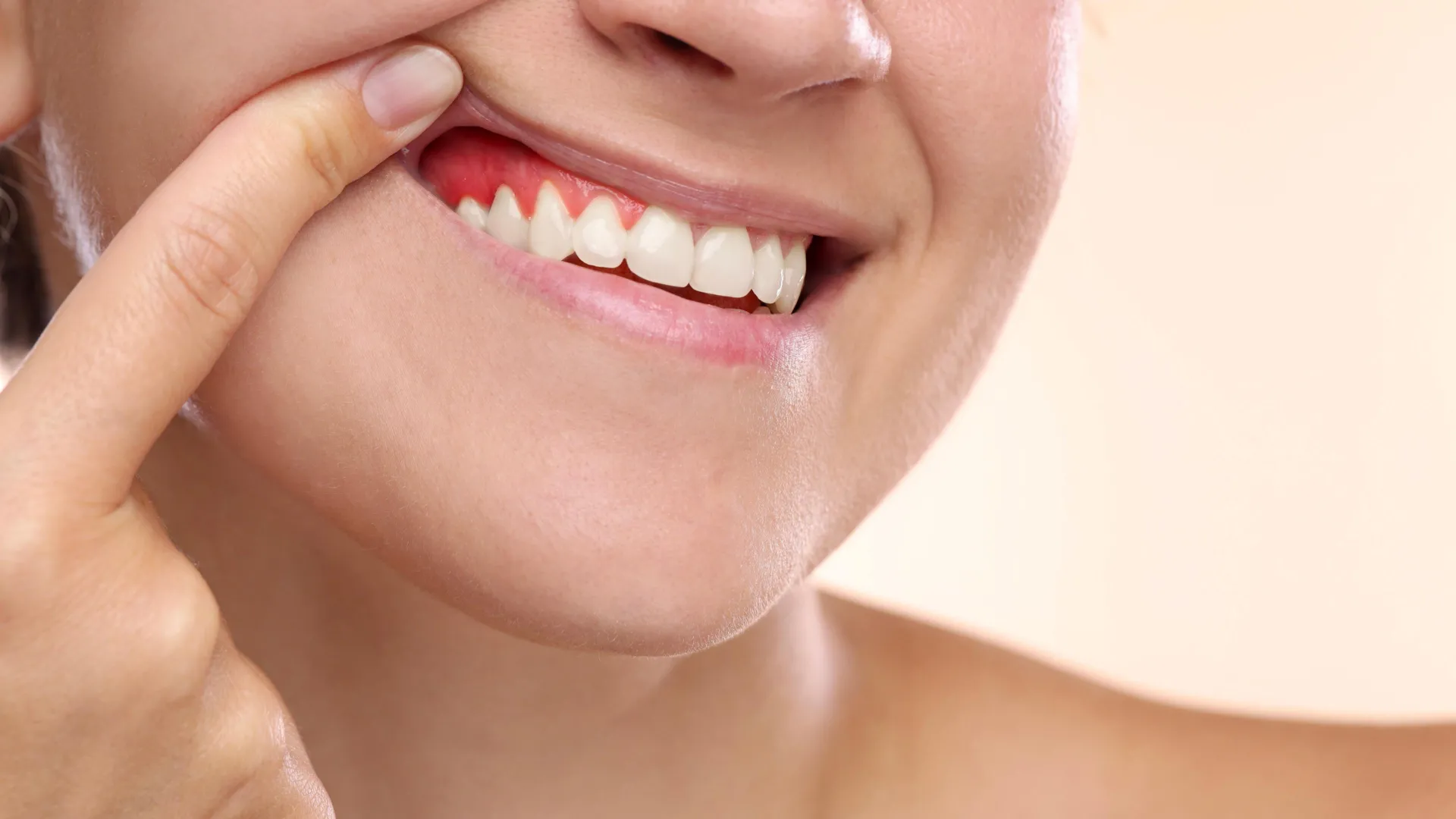 هل يمكن للصيام أن يحارب أمراض اللثة؟ يجد العلماء رابطًا مدهشًا