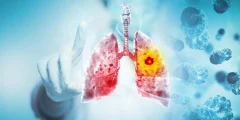 التدخين الإلكتروني وسرطان الرئة: دراسة جديدة تكشف المخاطر