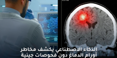 الذكاء الاصطناعي يكشف مخاطر أورام الدماغ بدقة