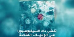 تفشي داء السيكلوسبورا في الولايات المتحدة: مصدر العدوى غير معروف
