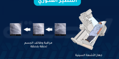 التنظير الفلوري: ما هو والغرض منه وطريقة إجرائه