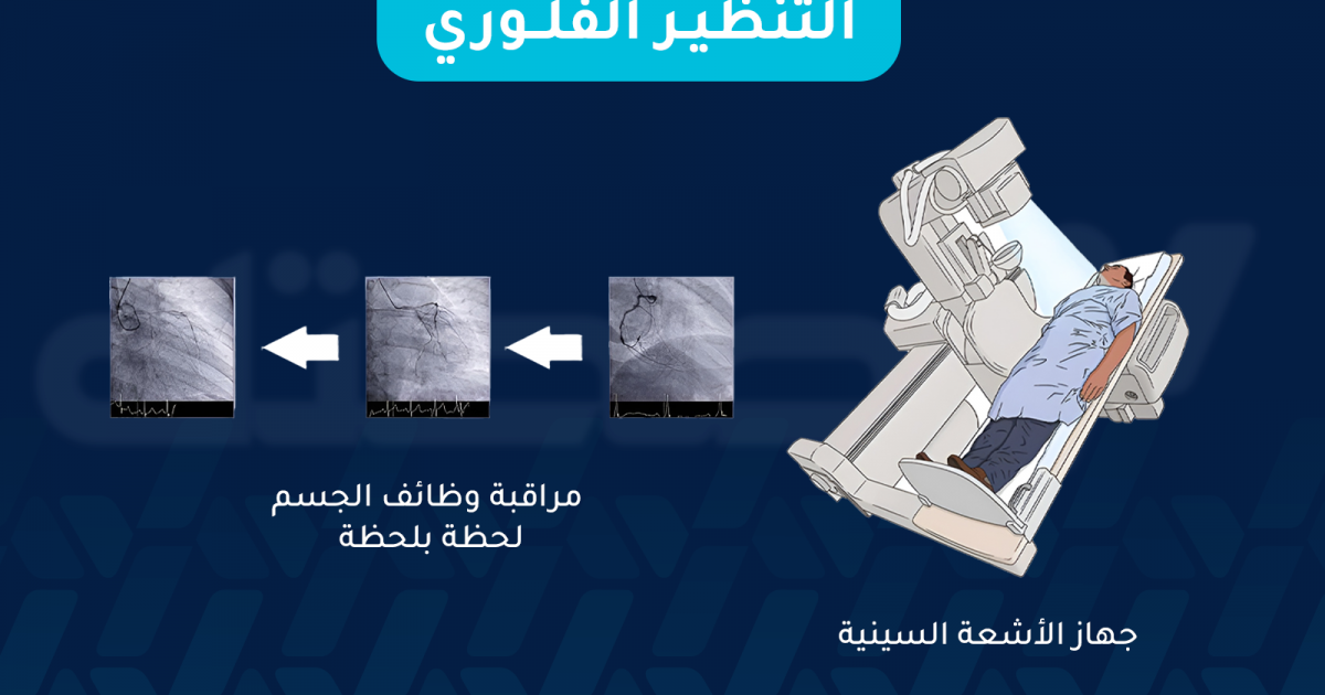 ما هو التنظير الفلوري وما الغرض منه وما طريقة إجرائه؟