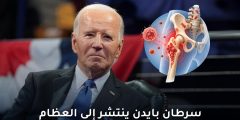 الحالة الصحية لجو بايدن: سرطان البروستاتا وانتشاره إلى العظام
