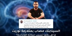 السينابتك مصاب بمتلازمة توريت: حقائق وأعراض