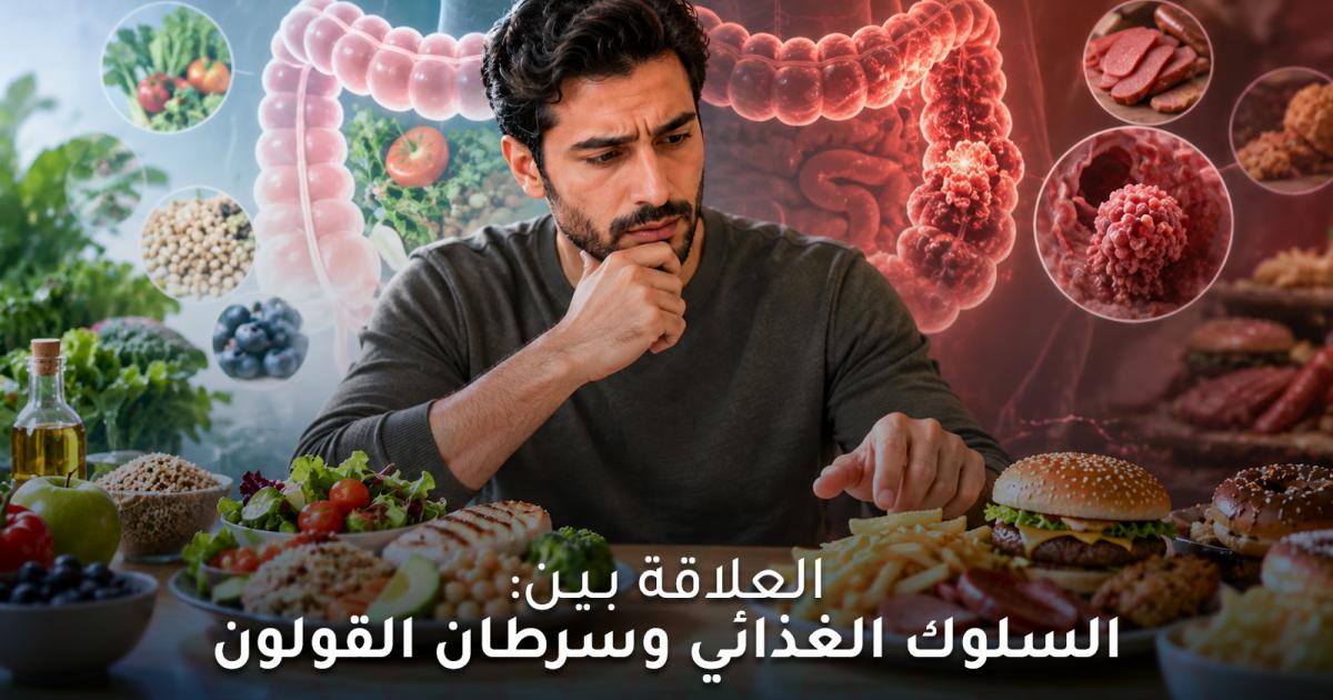 العلاقة بين السلوك الغذائي وسرطان القولون.. ماذا نعرف عنها؟
