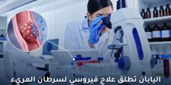 علاج فيروسي لسرطان المريء في اليابان: تطورات حديثة